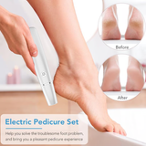 Moonval Electric Callus Remover, Rechargeable Foot Care Tool for Smooth Heels & Dry Skin