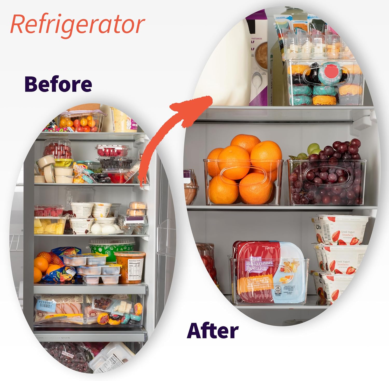 Moonval Pantry Storage Bins, Clear Organizers with Removable Dividers for Kitchen & Refrigerator